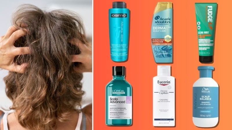  shampoo for dry scalp